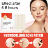 Hydrocolloid Acne Patches - Invisible Makeup, Closed Comedone, Acne-Fighting, Waterproof, Breathable Facial Care