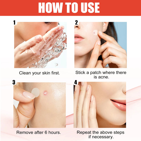 Hydrocolloid Acne Patches - Invisible Makeup, Closed Comedone, Acne-Fighting, Waterproof, Breathable Facial Care