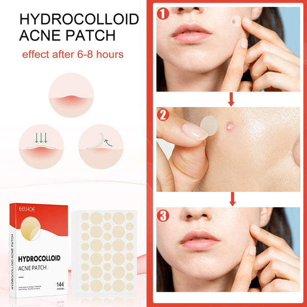 Hydrocolloid Acne Patches - Invisible Makeup, Closed Comedone, Acne-Fighting, Waterproof, Breathable Facial Care