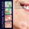 12/24PCS Micro Needle Pimple Patch Hydrocolloid Micropoint Pimple Patch For Acne & Pimples Microdart Patch Micro Dart Pimple