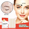 Hydrocolloid Acne Patches - Invisible Makeup, Closed Comedone, Acne-Fighting, Waterproof, Breathable Facial Care