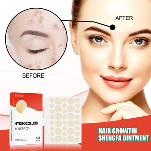 Hydrocolloid Acne Patches - Invisible Makeup, Closed Comedone, Acne-Fighting, Waterproof, Breathable Facial Care